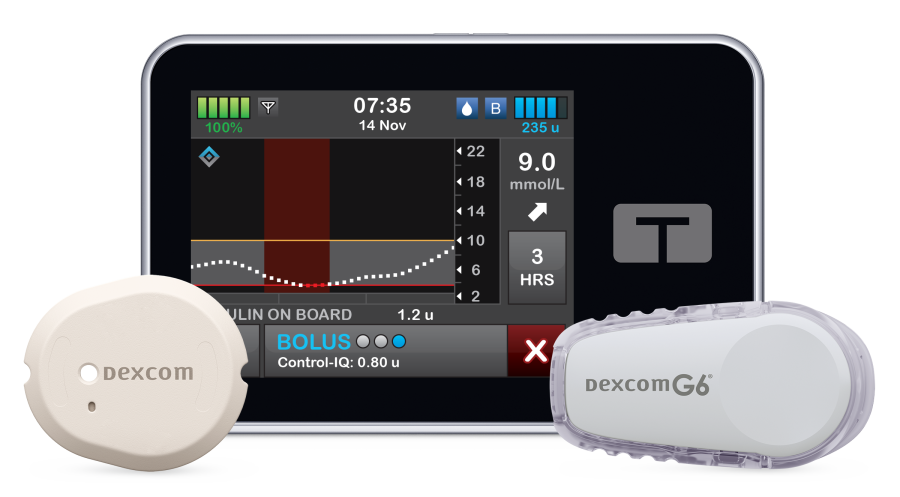 t:slim with Dexcom G6 and G7