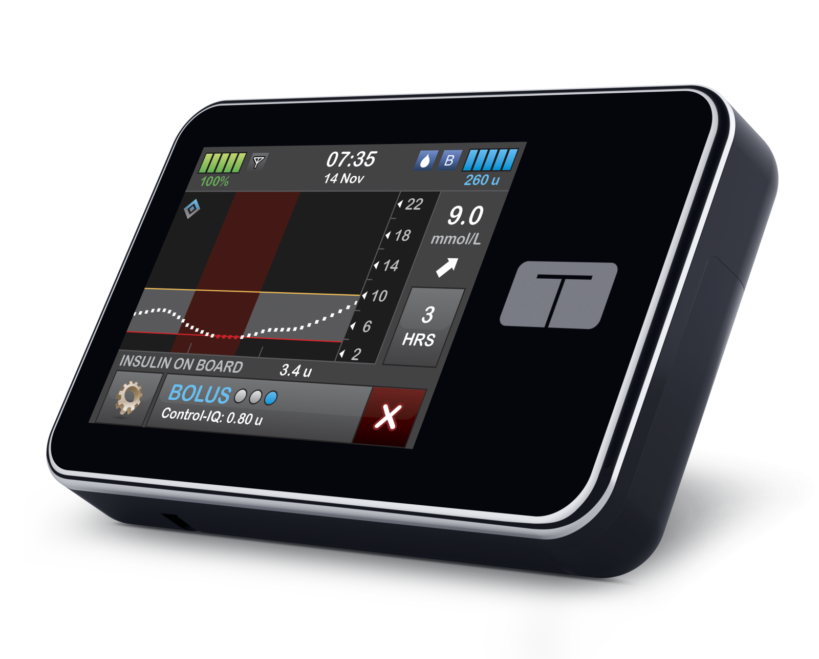 integrated insulin pump and cgm